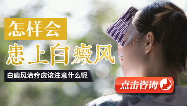 誘發白癜風的主要病因是什么
