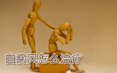 男人白癜風能治愈嗎