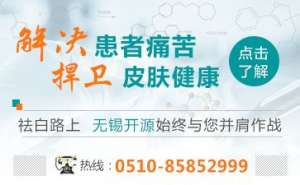 白癜風醫生朱厚長說明白癲風和其他皮膚病的區別