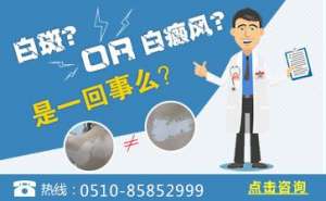 白癜風醫生袁仁軍詳談鹵米松和他克莫司