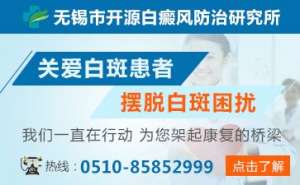 白癜風醫生袁仁軍詳談白癜風患者病情擴散