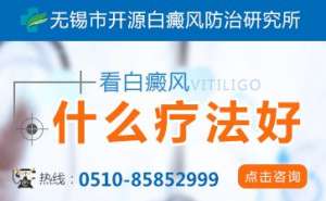 白癜風醫生袁仁軍詳談治好白癜風的藥膏